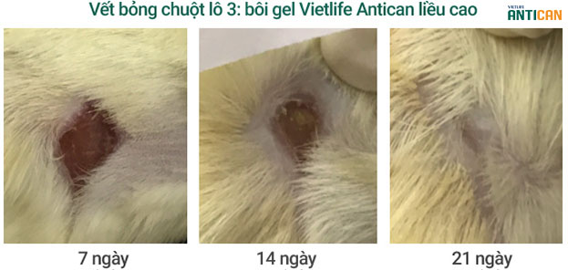 tác dụng của gel Antican đối với vết bỏng do nhiệt